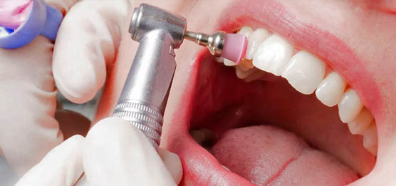 Эстетическая стоматология