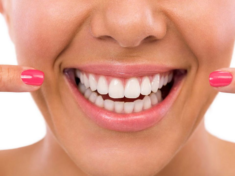 Как улучшить состояние зубов